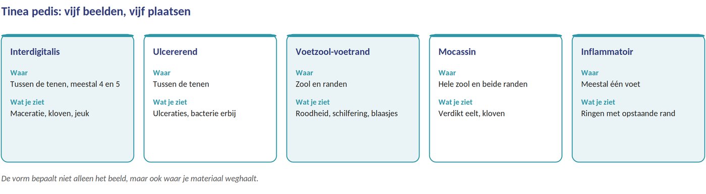 Vijf vormen van tinea pedis