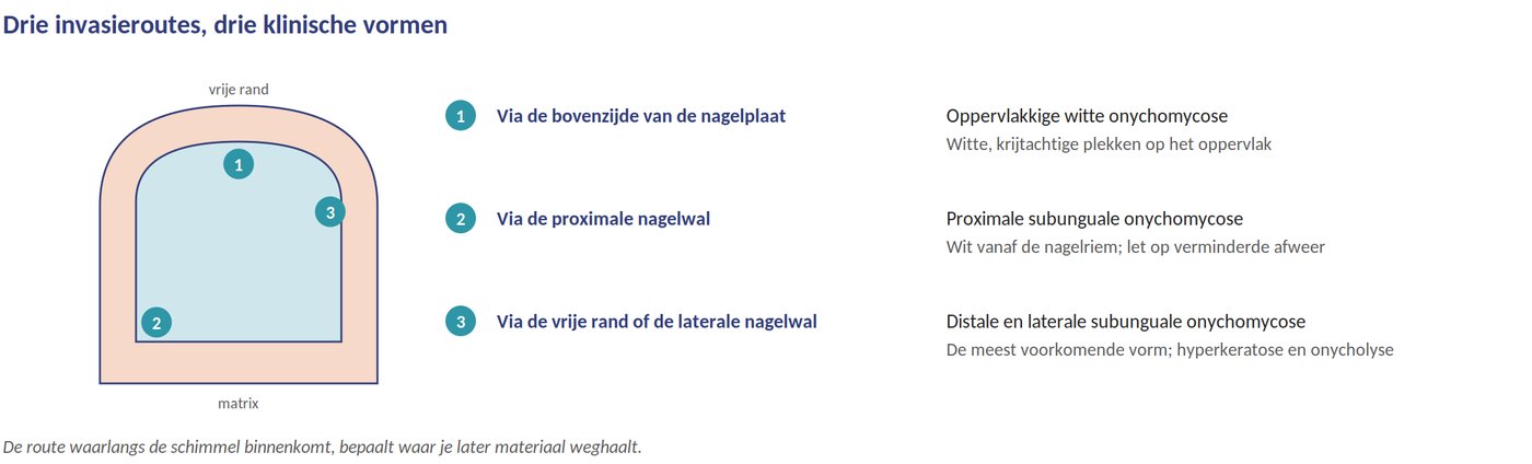 De invasieroutes
