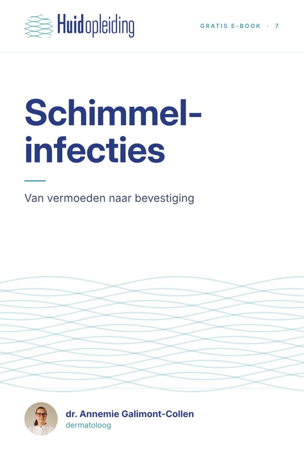 Kaft Schimmelinfecties